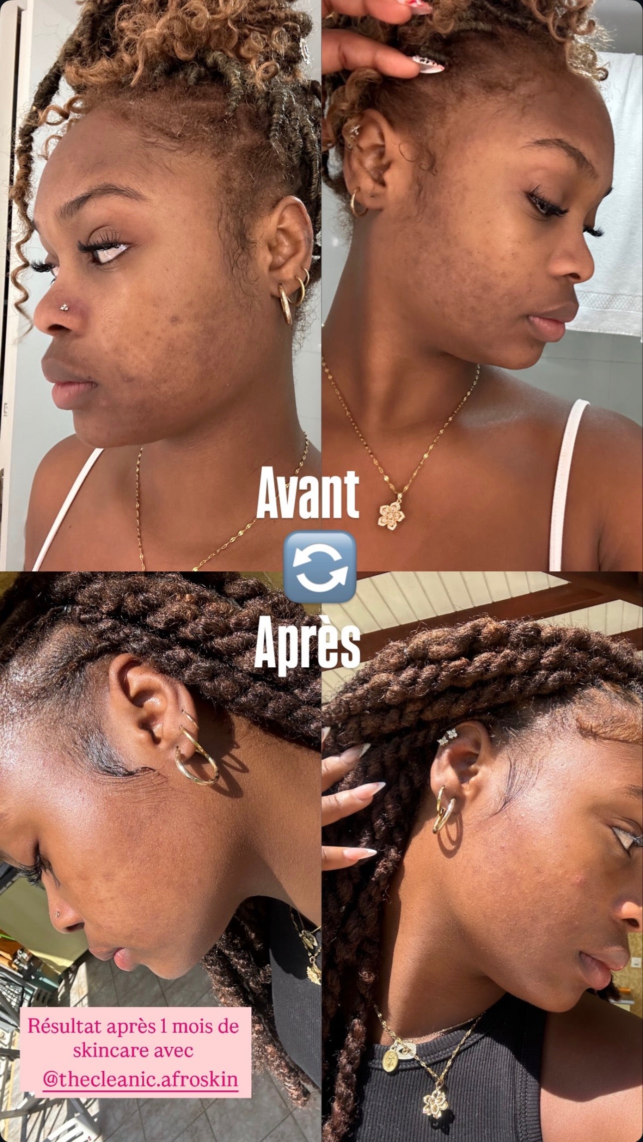 Soins du visage - B.